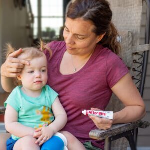 After Bite Kids - 20 g After Bite Kids - 20 g